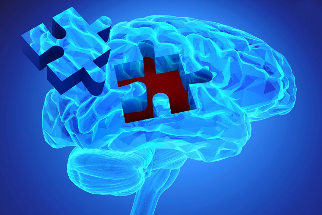 ALZHEIMERJEVA BOLEZEN