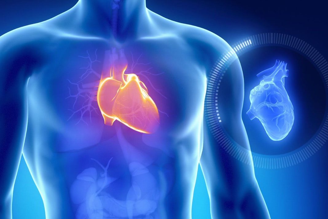 Angina pektoris