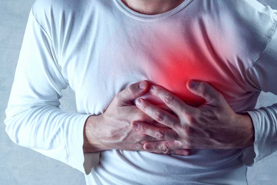 Angina pektoris
