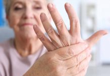 ARTRITIS – Prehranski dodatki, ki bodo pomirili boleče sklepe