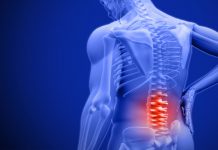 BOLEČINE V HRBTU – 9 prehranskih dodatkov, ki pomagajo odpraviti in lajšati bolečine v hrbtu