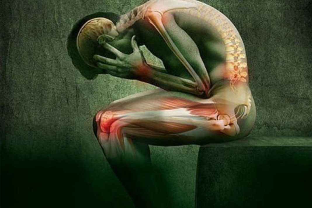Fibromialgija