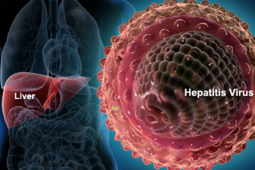 Hepatitis