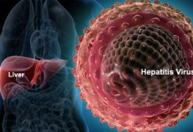 Kronični hepatitis – Kaj in kako s prehrano?
