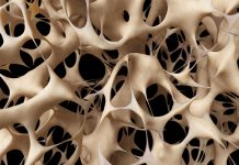 OSTEOPOROZA – S prehranskimi dopolnili nad krhke kosti