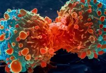 RAK (RAKAVO OBOLENJE)