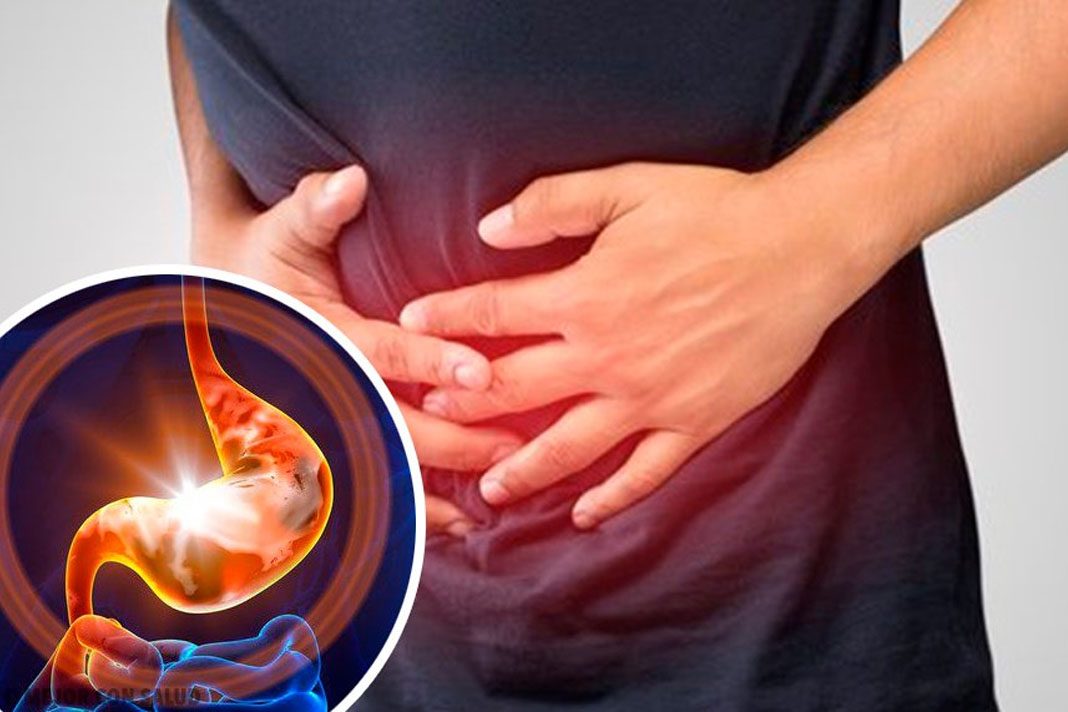 gastritis
