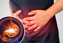 Gastritis in gastropatija – Kako in kaj storiti s prehrano ob vnetju želodčne sluznice?
