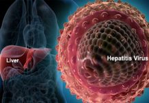 HEPATITIS – Prehranski dodatki, ki pomagajo osebam s hepatitisom