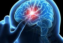 MOŽGANSKA KAP – 7 TOP prehranskih dopolnil po MOŽGANSKI KAPI