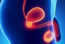 POVEČANA PROSTATA – Prehranski dodatki, s katerimi si lahko pomagate pri povečani prostati