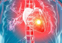 Srčno popuščanje – Pri bolezni srca nam lahko pomaga tudi zdrava prehrana