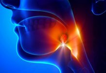 Tonzilitis – Kako premagati okužbo tonzil s pravilno prehrano