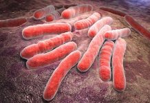 Tuberkuloza – Nevarna bolezen in prehranska priporočila