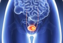 VNETJE MEHURJA – Prehranska dopolnila, ki zdravijo vnetje mehurja