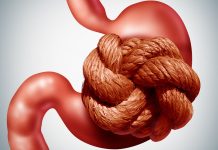 ZAPRTJE -Prehranski dodatki, s katerimi si lahko odpravimo zaprtje