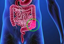 Zaprtje – Ob zaprtju si pomagajmo s pravilno prehrano