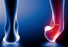 ZVIN, IZPAH IN NATEG MIŠICE – 8 TOP prehranskih dopolnil, ki zdravijo ZVIN, IZPAH in NATEG MIŠICE