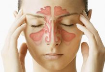 Vnetje sinusov / Sinusitis – Pozdravite vnetje z akupresuro