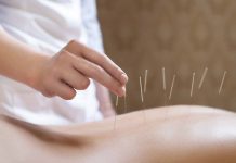 Kaj je akupunktura?